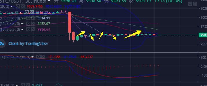 MACD