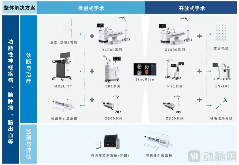 3D结构光注册技术