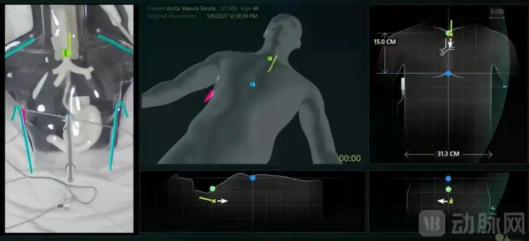 ENvue Medical