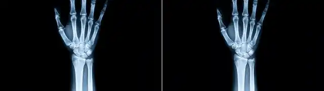 界面世界模型